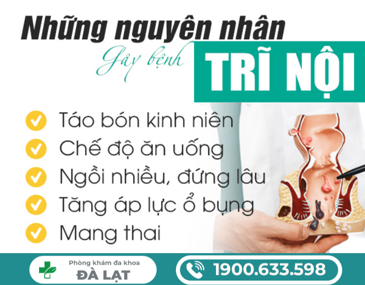 Hình ảnh minh họa